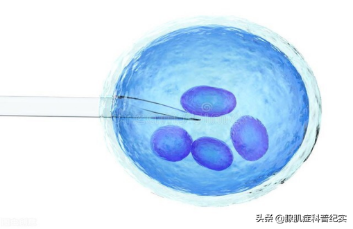 香港验血中介要收费吗,腺肌症患者在什么情况下可以做试管婴儿？