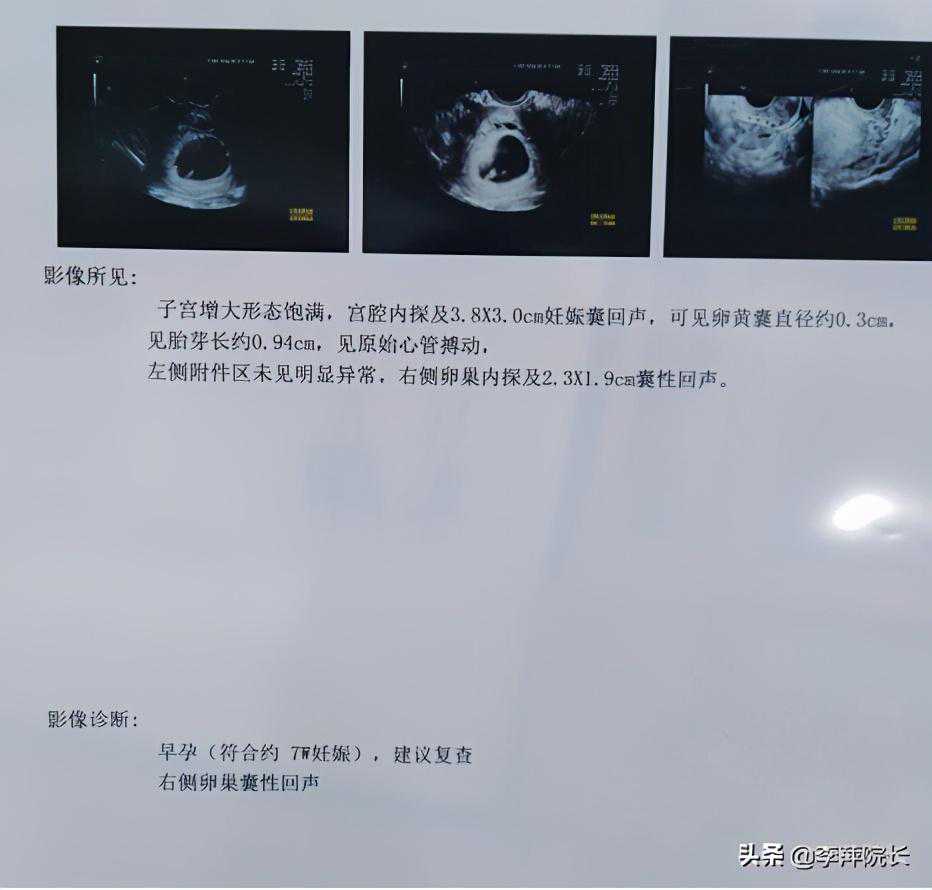 香港验血报告结果查询,宫外孕后去做试管，连续两次都失败，老主任：你绕了