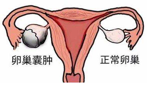 香港验血测男女46天准吗,做人流会导致不孕不育吗