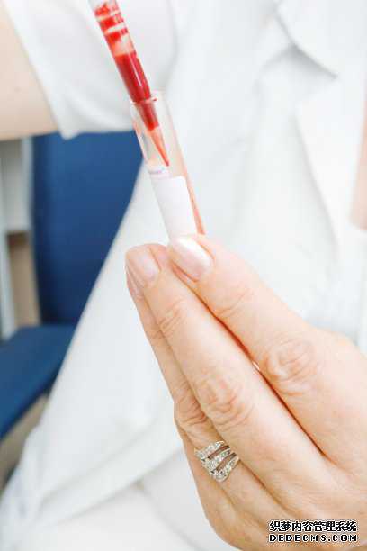 香港验血报告查看_专业性别检测安排科学精准
