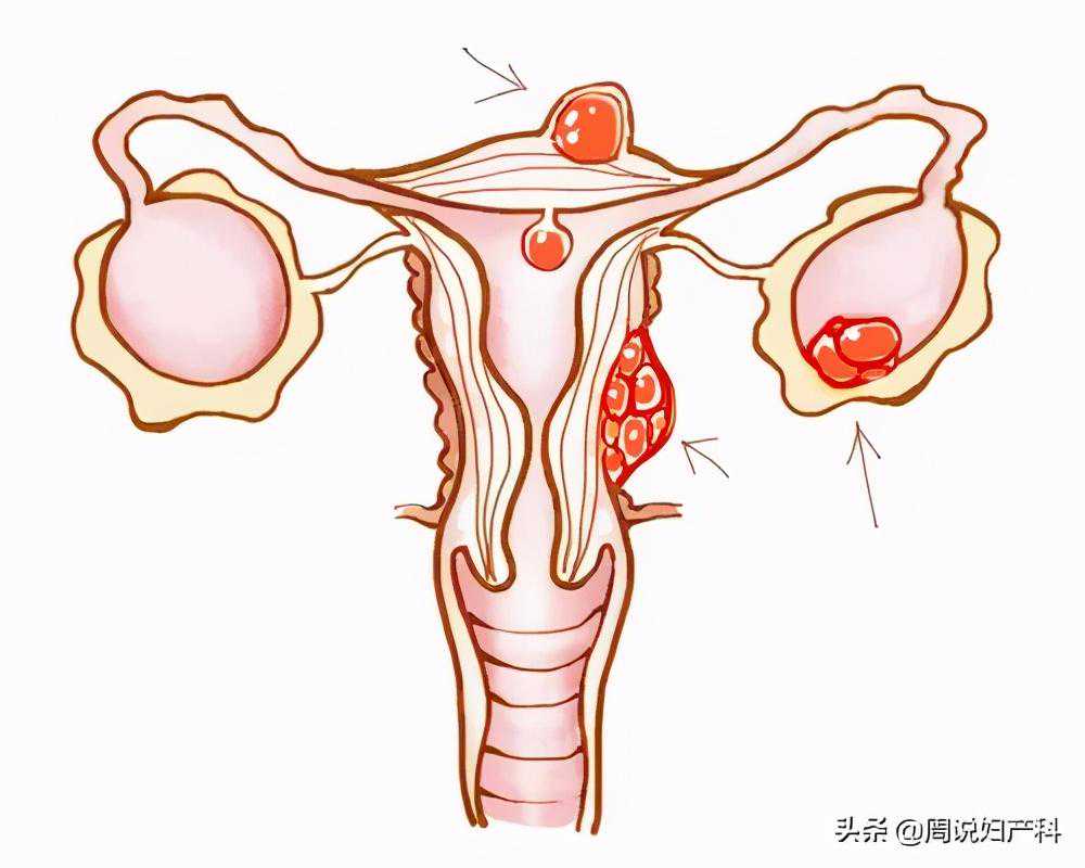 感冒了去香港验血查男女有影响吗,月经期的子宫内膜厚度多少正常