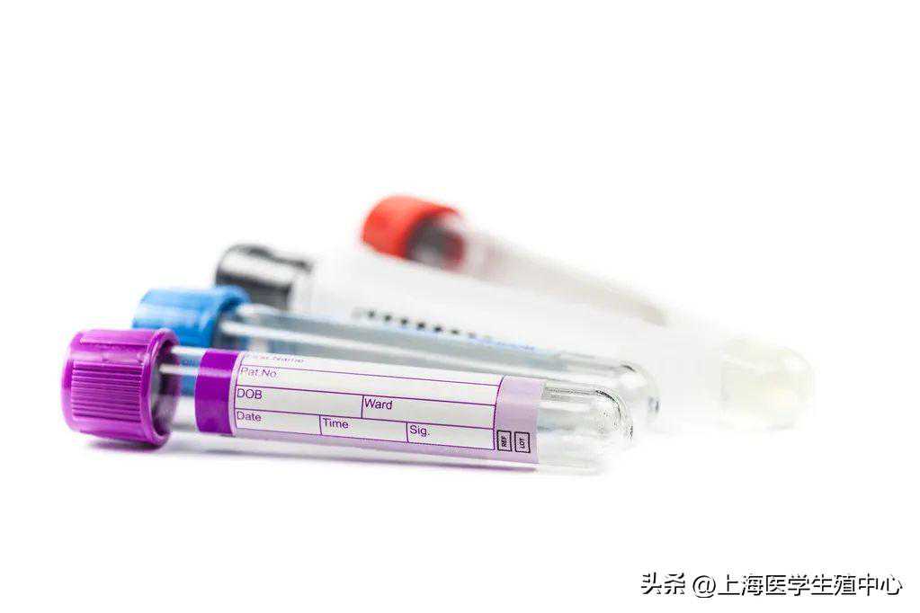 香港验血测性别时间限制,大龄备孕试管婴儿之前，这几个检查必不可少！